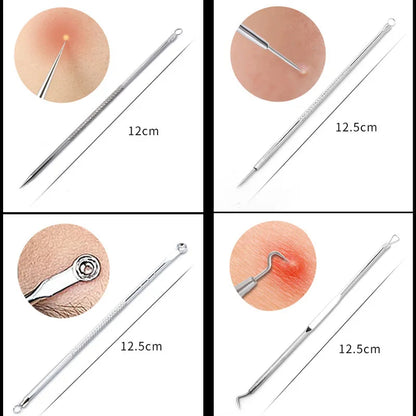 Precision Acne Remover - Stainless Steel Blackhead and Pimple Removal Needle